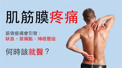 筋骨受傷|肌肉、筋骨、脊椎……痠痛問題要看哪一科？